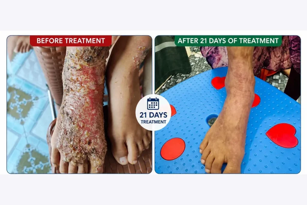 Supplied before-and-after graphic showing skin on a foot and ankle.