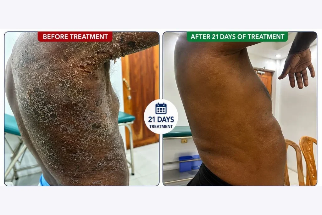 Supplied before-and-after graphic showing skin on the torso.
