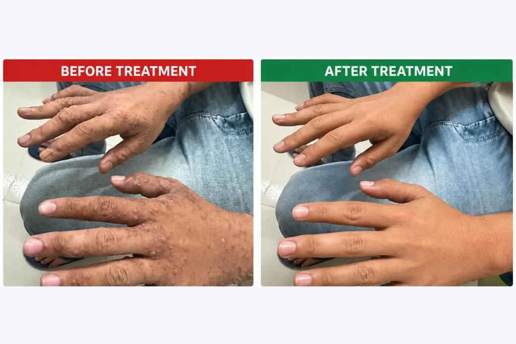 Supplied before-and-after graphic showing skin on the hands.