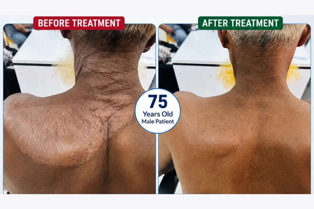 Supplied before-and-after graphic showing skin on the neck and upper back.